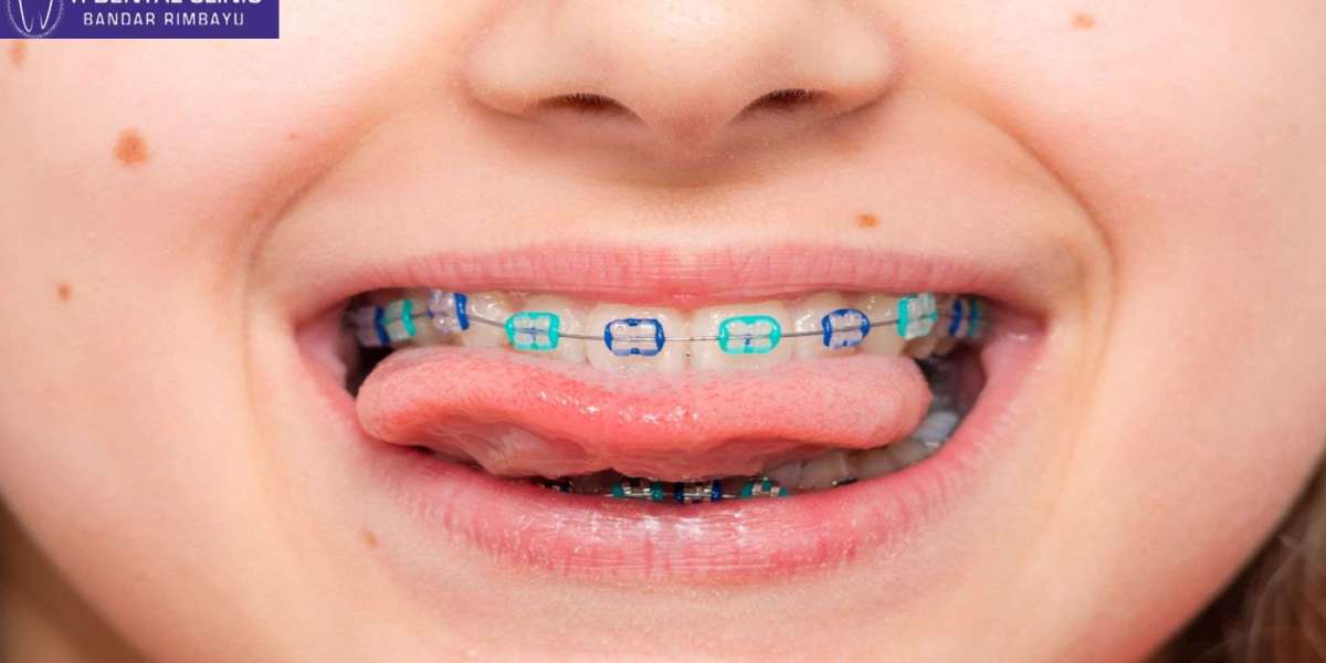 A Parent's Guide to Orthodontics (Tidental)